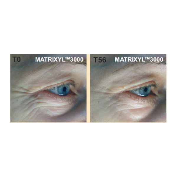 Spa salonnepro - Anti-gravity lifting serum