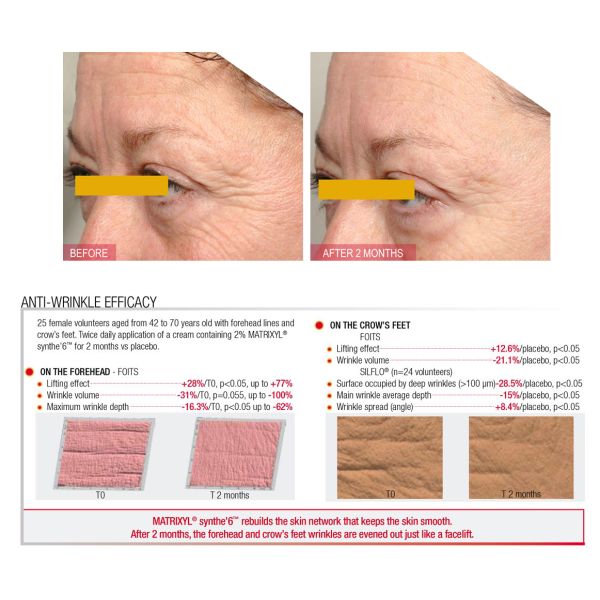 Spa salonnepro - Anti-aging serum